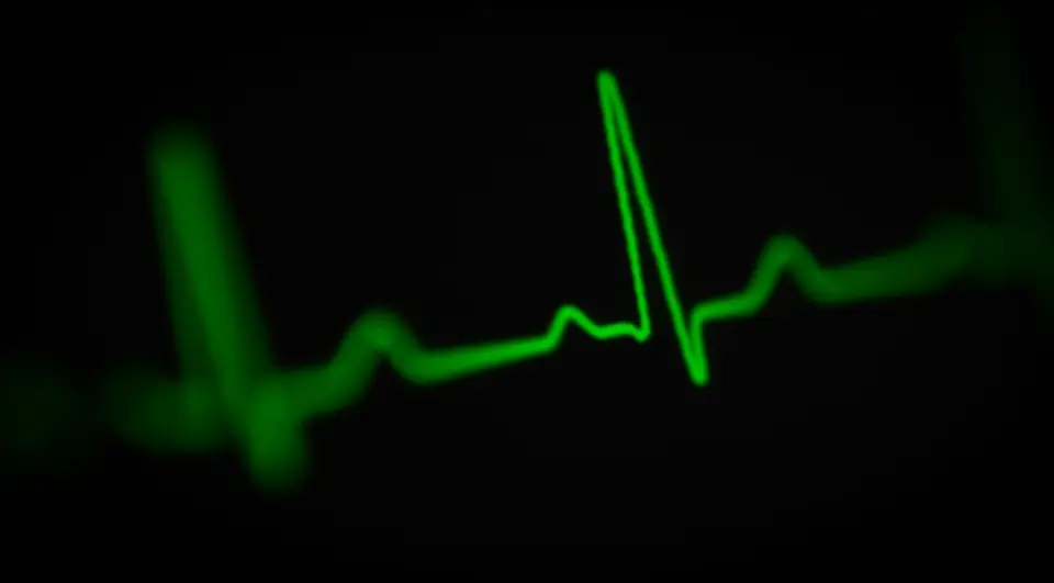 心臟監測商 iRhythm 第三方代管商業應用遭未授權存取、病患 PHI 外洩遭勒索的示意