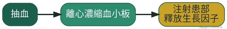 PLT凍晶治療流程示意圖，抽血、離心濃縮血小板、注射患部釋放生長因子三步驟以箭頭依序連接
