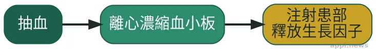 PLT凍晶治療流程示意圖，抽血、離心濃縮血小板、注射患部釋放生長因子三步驟以箭頭依序連接
