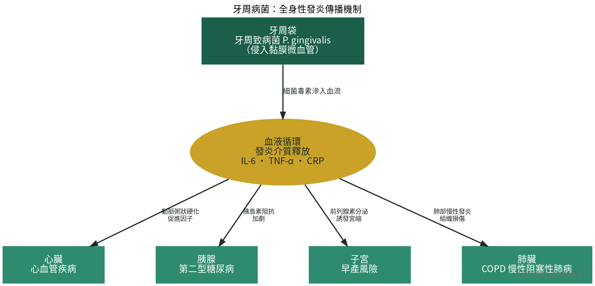 牙周病致病菌與發炎物質經由血液循環影響心臟、胰腺、子宮等全身器官的機制示意圖