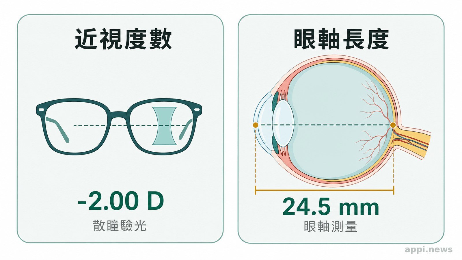 兒童近視風險分層與連續追蹤線索