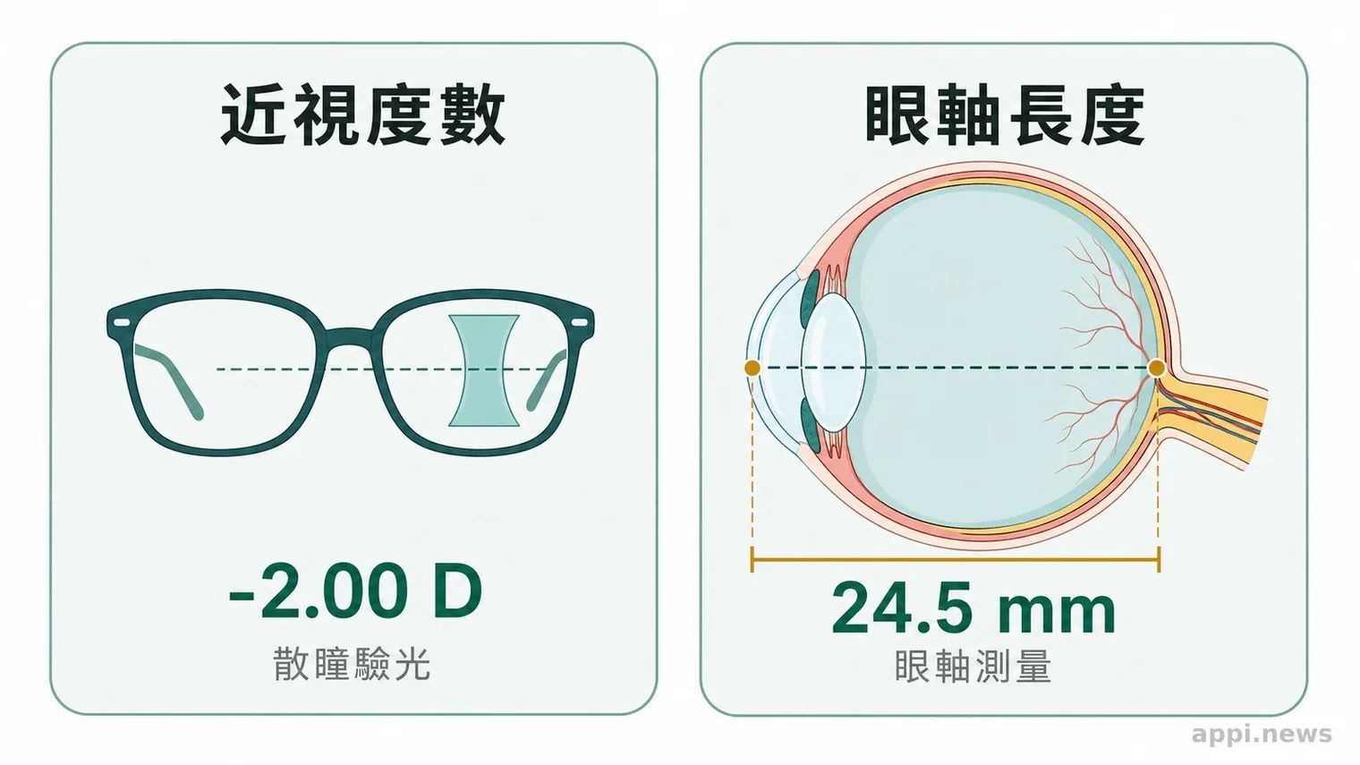 兒童近視風險分層與連續追蹤線索