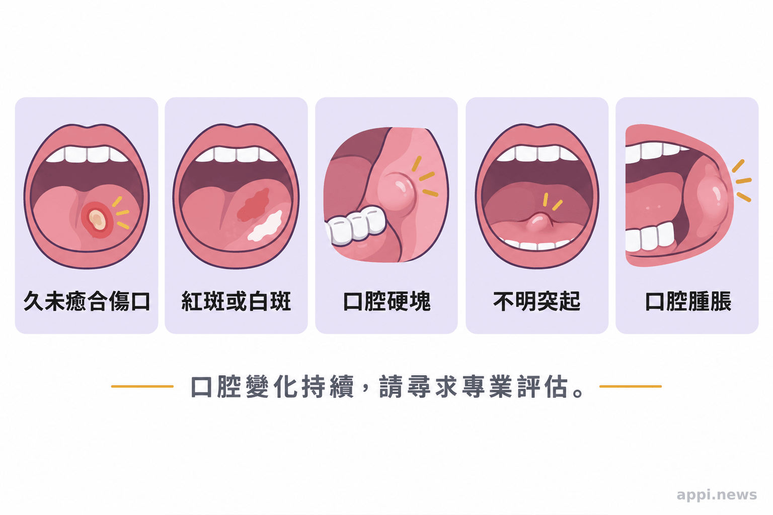 口腔自我觀察五項提示：傷口、紅白斑、硬塊、突起與腫脹