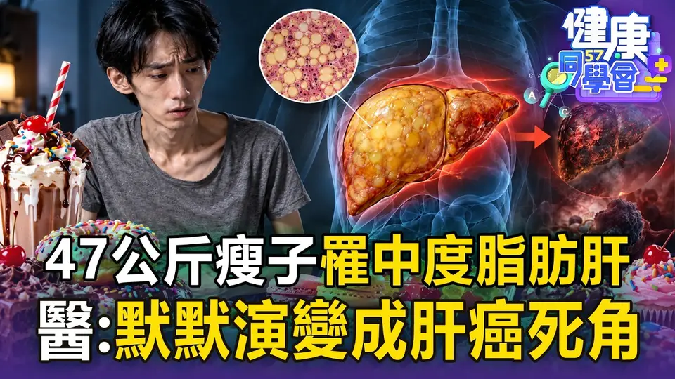 （2026-09-23）47公斤瘦子竟罹中度脂肪肝！ 狂吃甜食堆出「肝包油」 醫警告：默默演變成肝癌死角【57健康同學會】