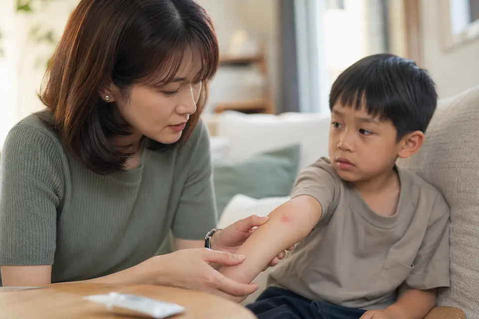 台灣家長在家中查看孩子前臂上的蚊蟲叮咬紅腫處