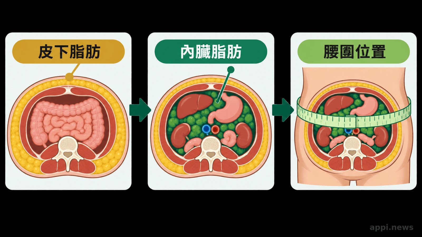 代謝風險評估可整理的腰圍、健檢數值與生活型態項目