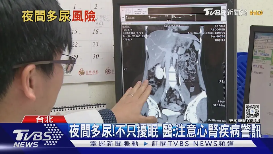 （2026-08-27）半夜頻跑廁所不只攝護腺! 醫揭夜間多尿恐是心臟.腎臟疾病警訊｜十點不一樣20260827 @TVBSNEWS01